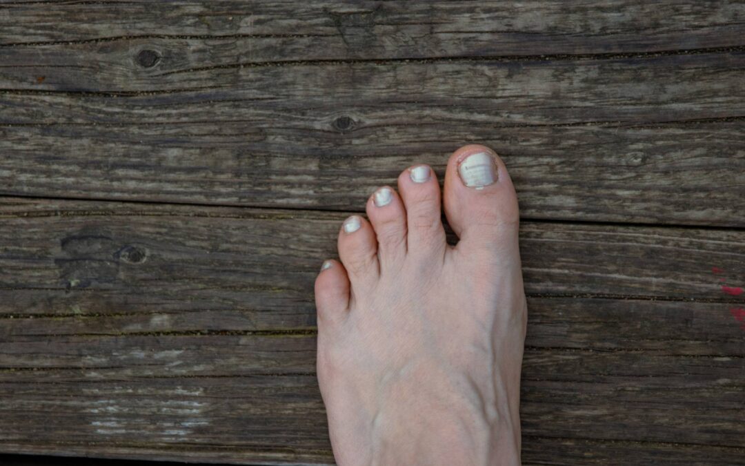 Don’t Walk on a Broken Foot: Getting Relationship Help Sooner Rather Than Later